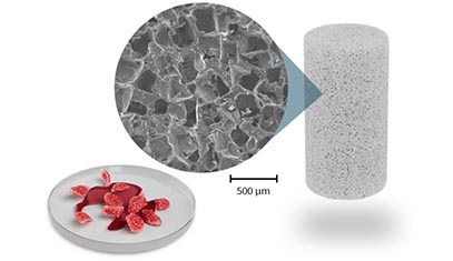 The Citregraft bone regeneration device
