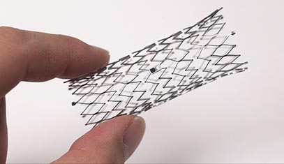 A millimeter-scale pacemaker integrated with a stent