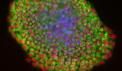A micrograph of induced pluripotent stem cells (iPSCs)