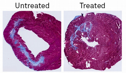 treated and untreated red stained aorta cross section 